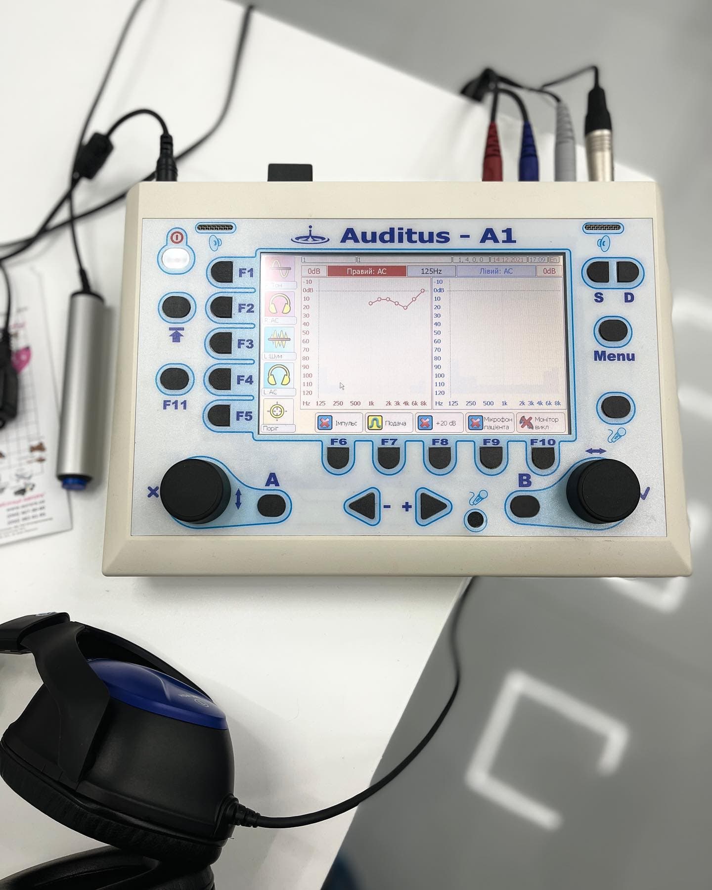 Аудіометрія