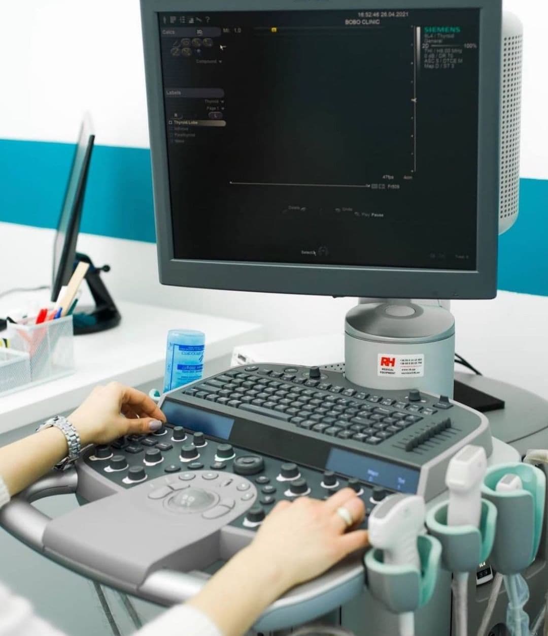 УЗД з еластографією